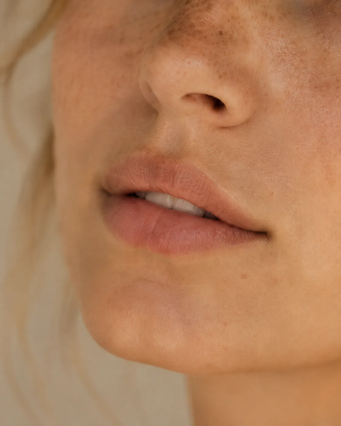 Patiente phototype foncé — épilation laser