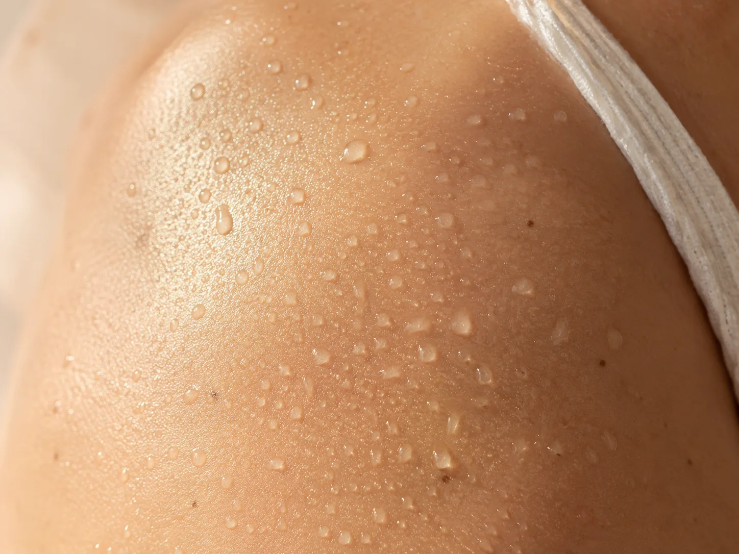 Épilation laser médicale Dermelia