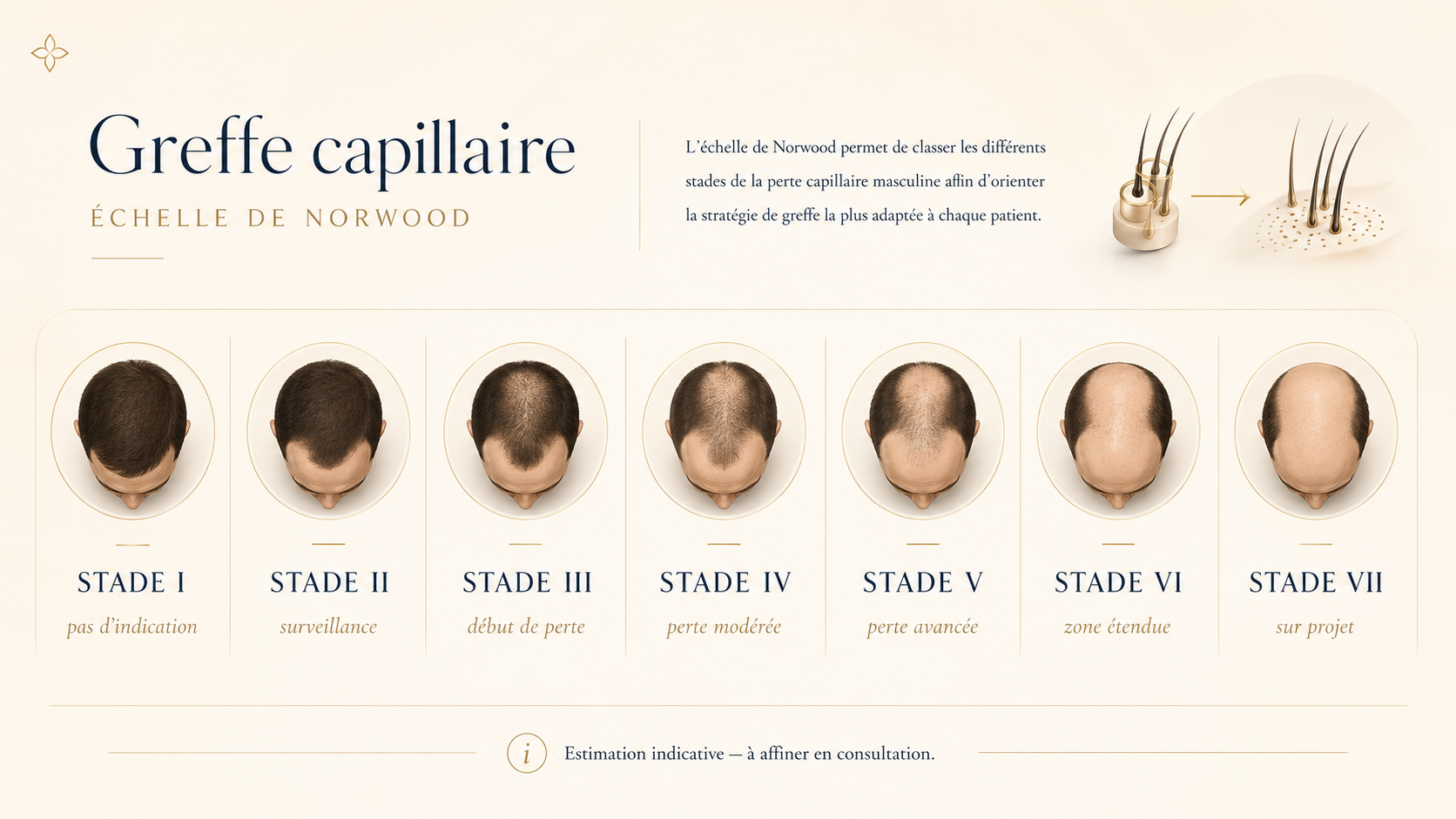 Échelle de Norwood : les 7 stades de l'alopécie androgénétique masculine, du stade I (pas d'indication) au stade VII (sur projet) — référence internationale utilisée pour orienter la stratégie de greffe.