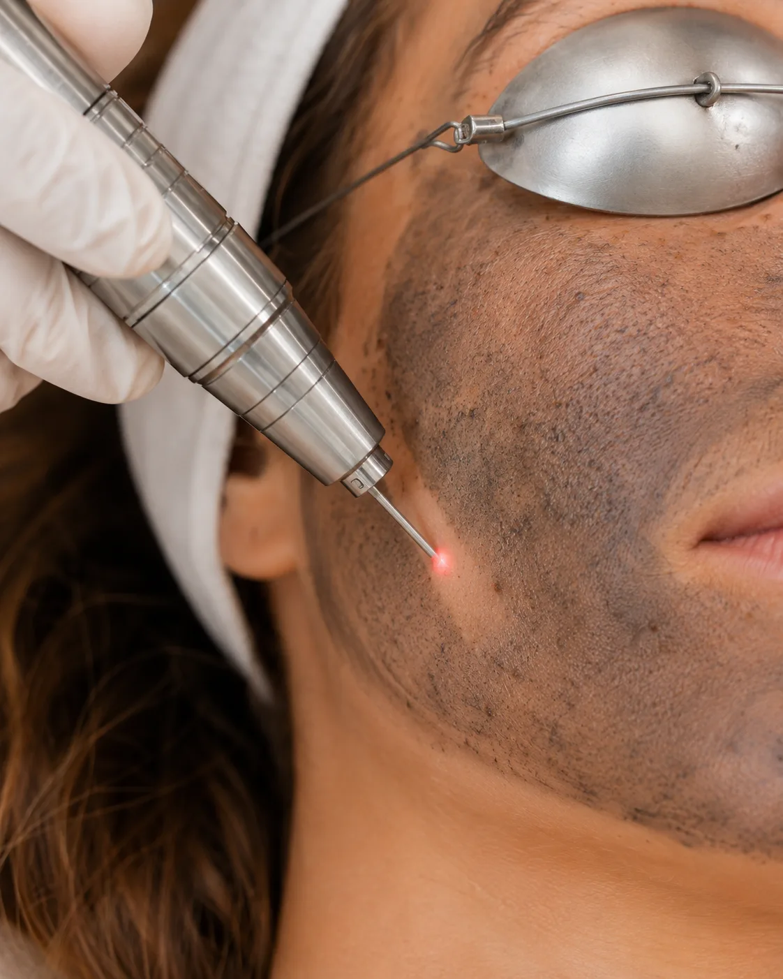 Guide comparatif Hollywood Peel ou Hydrafacial