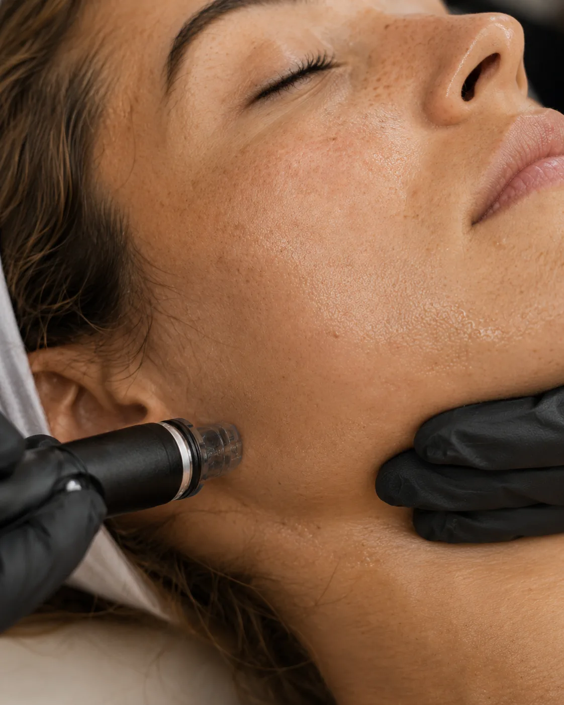 Sérums boosters Hydrafacial, ouverts à la séance Dermelia