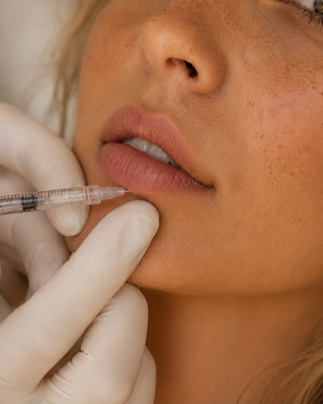 Tarifs injections — grille complète Marseille